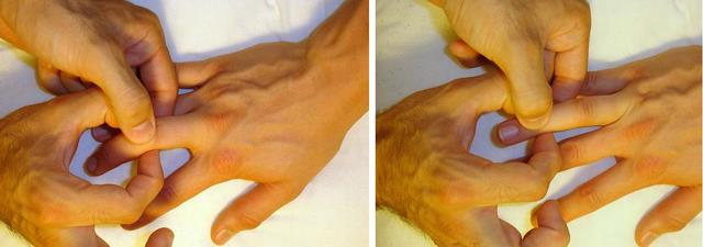 Use your index finger and thumb to make 'Cs' with each hand.  Each 'C' should either examine the palmar - dorsal aspect of each joint, or medial - lateral.  Left: PIP joint examination.  Right:  DIP joint examination.