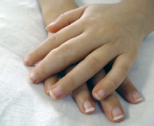 Hands of a child with JRA.  Note the swelling of the middle finger PIP. (©iStockphoto.com/JynMeyer)