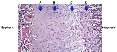 Growth plate