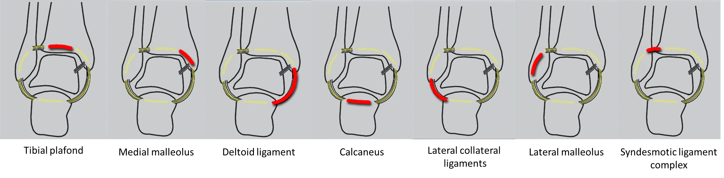 Ankle stability