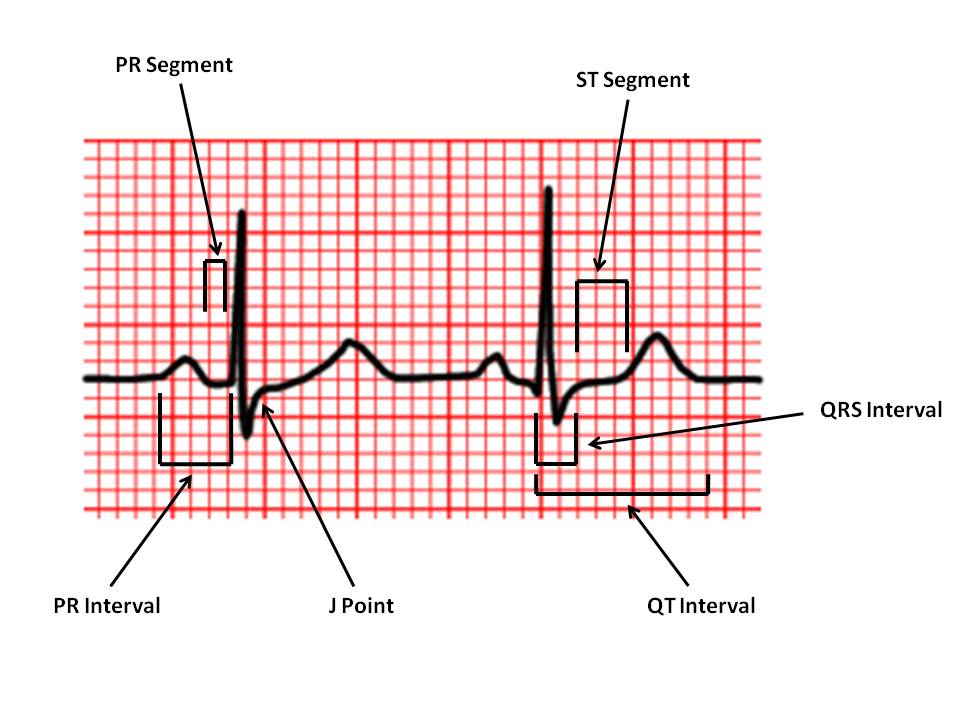 Intervals And Segments