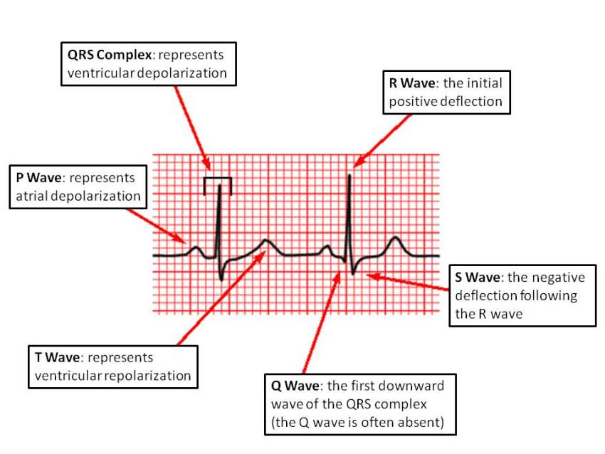 waves-and-complexes