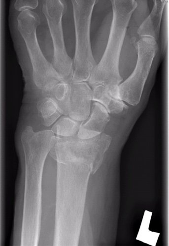 wrist1.jpg