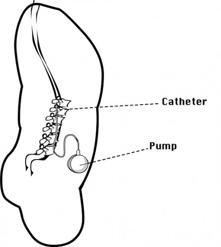 baclofen.jpg