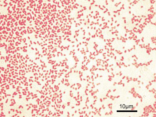 pseudomonas_aeruginosa_gram.jpg